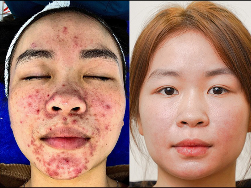 bac-si-khuyen-cao-4-kieu-da-can-duoc-dieu-tri-ngay