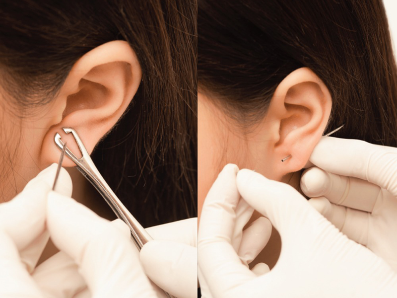 bam-khuyen-o-vanh-tai-co-gai-18-tuoi-gap-di-chung-nang