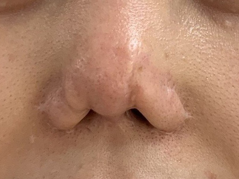 dep-tro-lai-sau-6-nam-sua-mui-bien-dang