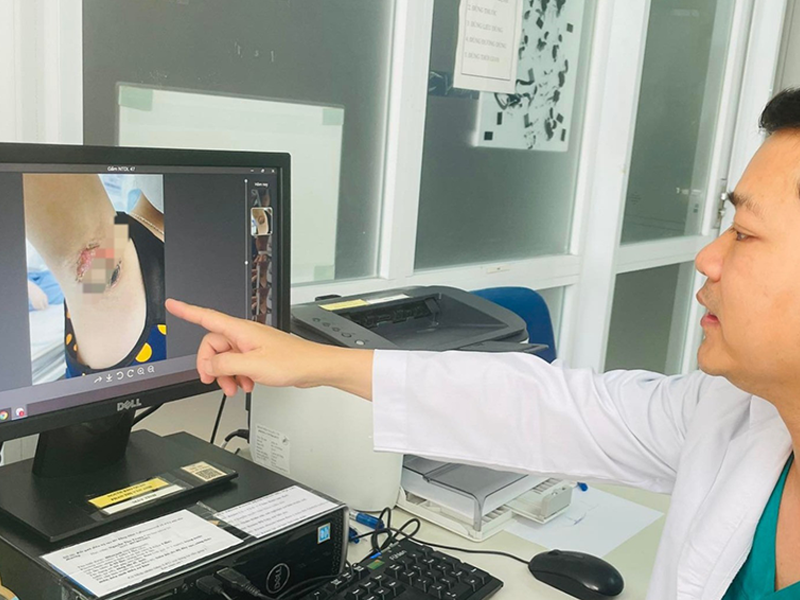 hai-nach-bien-dang-sau-khi-chua-benh-nhay-cam-tuoi-day-thi