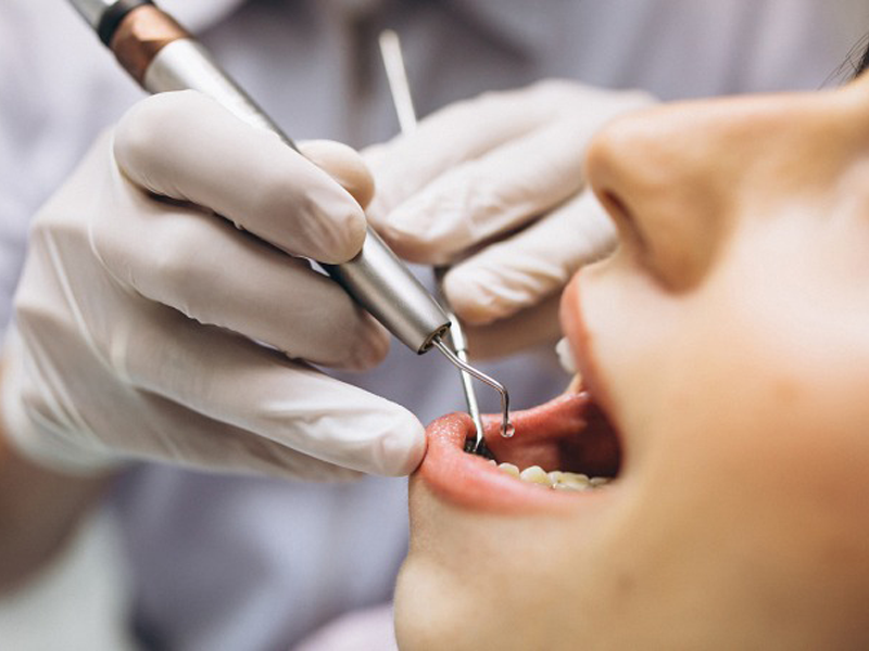 hoi-han-sau-khi-chi-hon-100-trieu-dong-lam-rang-su-tham-my