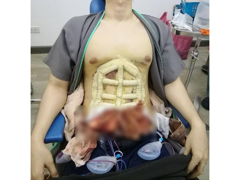 khong-muon-tap-luyen-nam-gioi-co-the-bien-bung-bia-thanh-6-mui