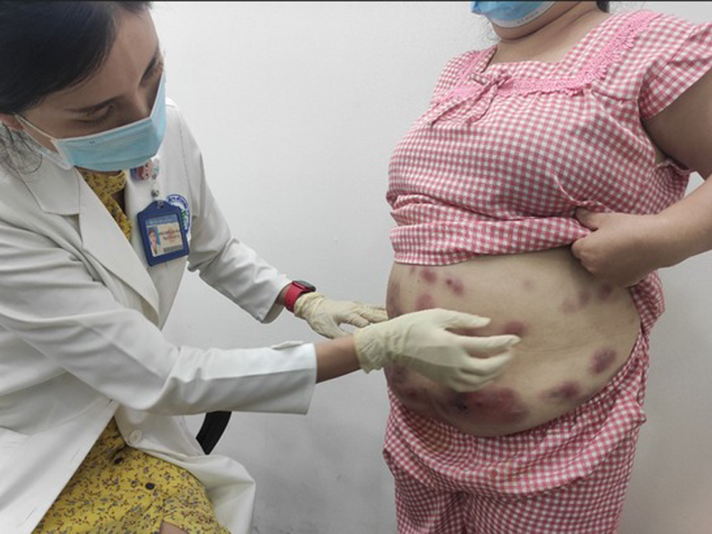 ly-do-bac-si-khong-vui-khi-chua-chay-cho-co-gai-gap-tai-bien-vi-tiem-tan-mo