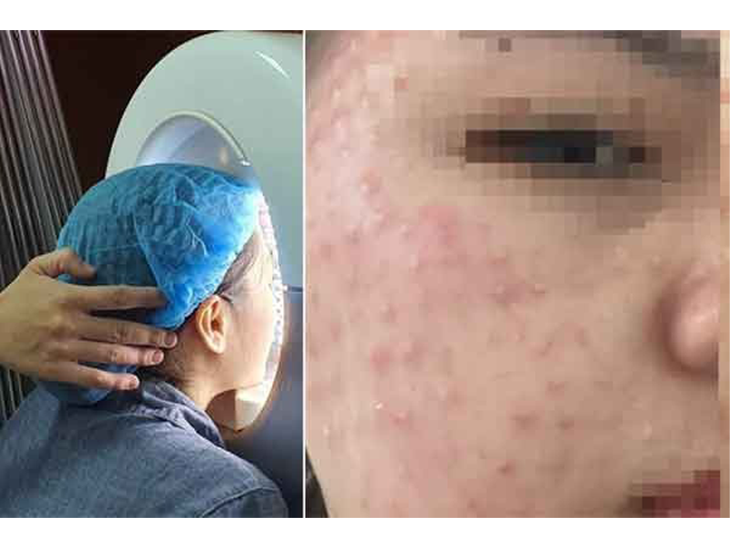 mat-nhu-to-ong-sau-buoi-tiem-chat-doc-quyen-lam-dep-da-mien-phi