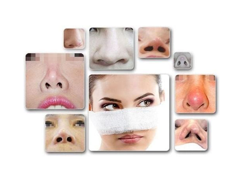 nang-mui-cau-truc-va-nhung-bien-chung-muon