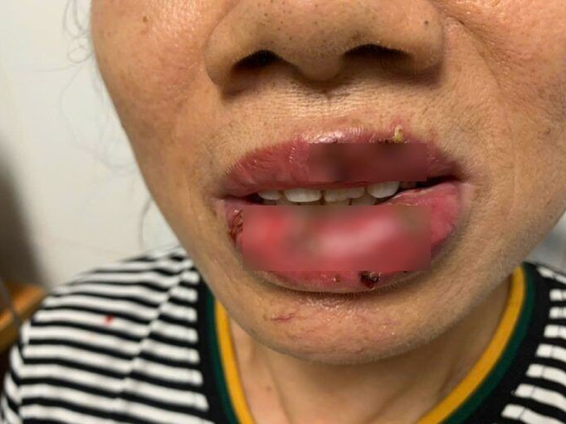 nguoi-phu-nu-u70-cau-cuu-bac-si-sau-5-ngay-xam-moi