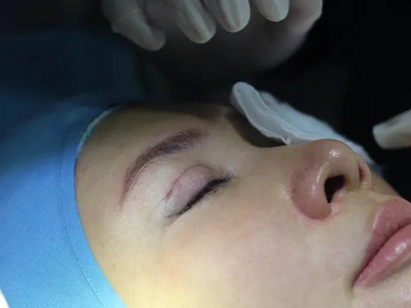 nhung-nguyen-nhan-gay-nhan-mi-cat-mi-hong