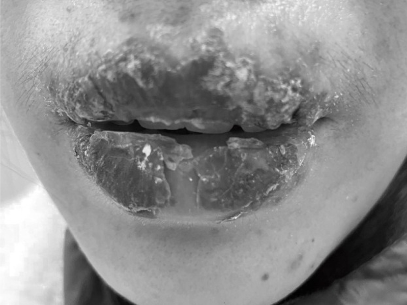 nu-sinh-15-tuoi-nat-moi-vi-theo-chi-di-xam