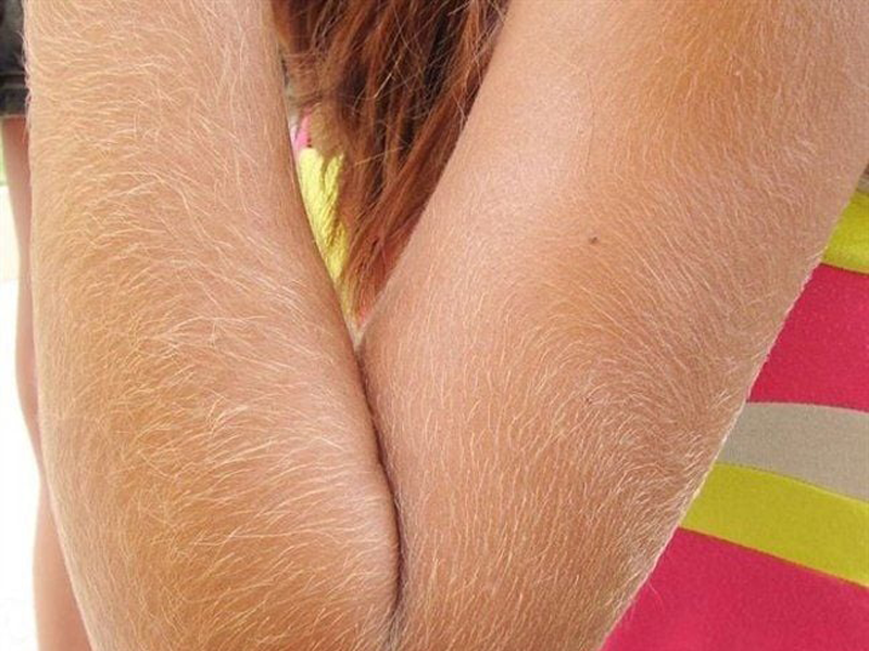 phu-nu-ram-long-phai-xu-ly-nhu-the-nao