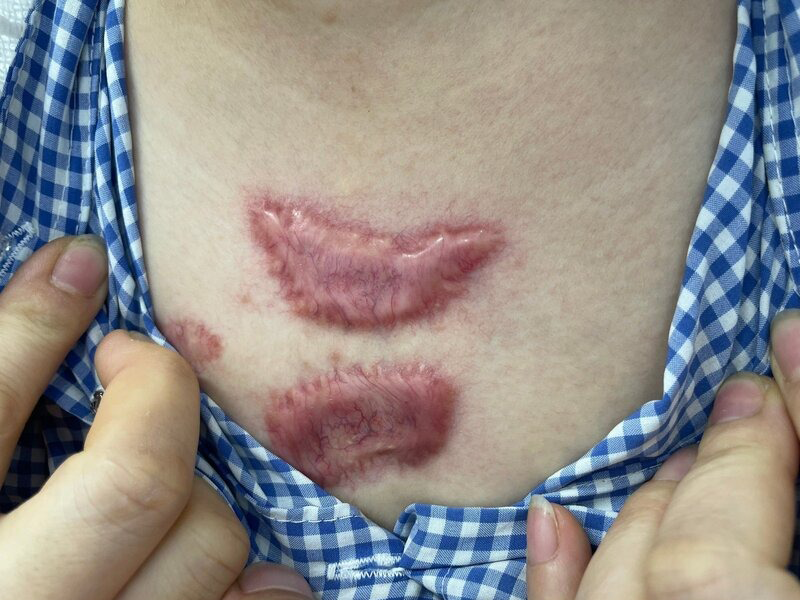 su-that-ve-quang-cao-chua-seo-chi-mot-lan-duy-nhat