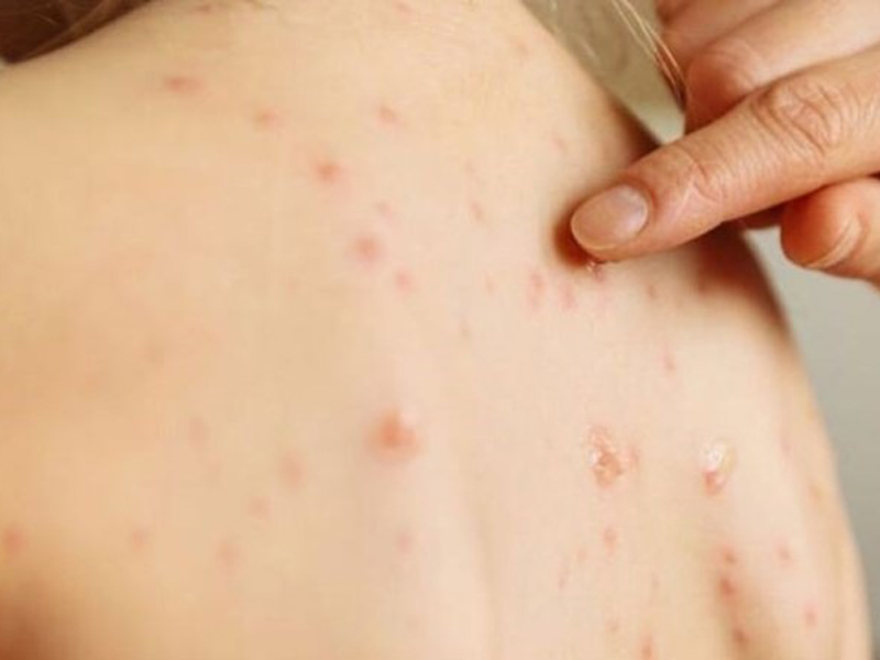 ban-soi-co-ngua-khong