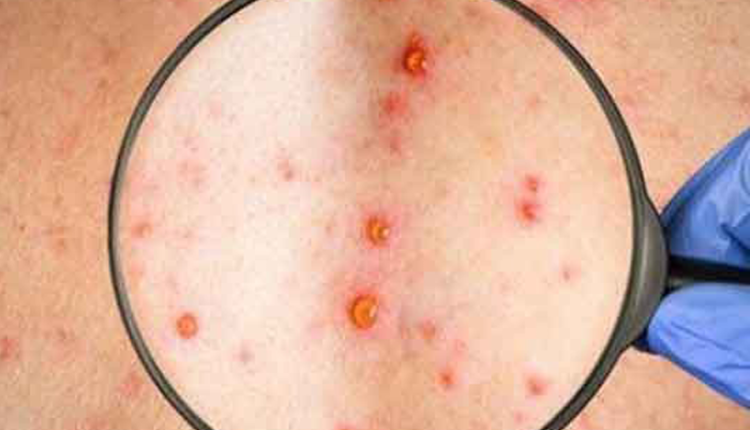 ban-soi-co-ngua-khong-nhung-dieu-can-biet-de-nhan-dien-va-cham-soc-dung-cach